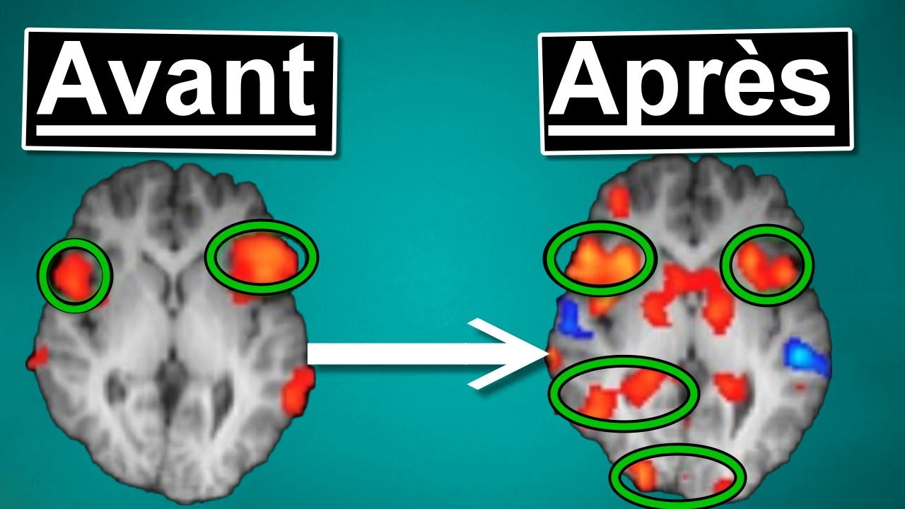 Brain Hack : Comment transformer votre cerveau en super ordinateur (en ...